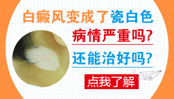 诊断治疗-得了白癜风应该如何治疗比较好呢-